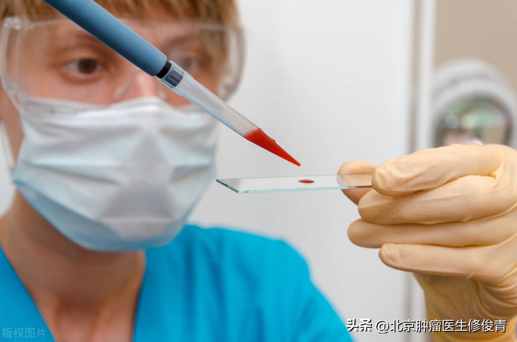 血尿会是前列腺癌吗,血尿会是尿路感染吗