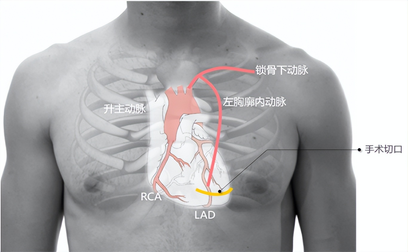 一线生机高清完整版,一线生机电影