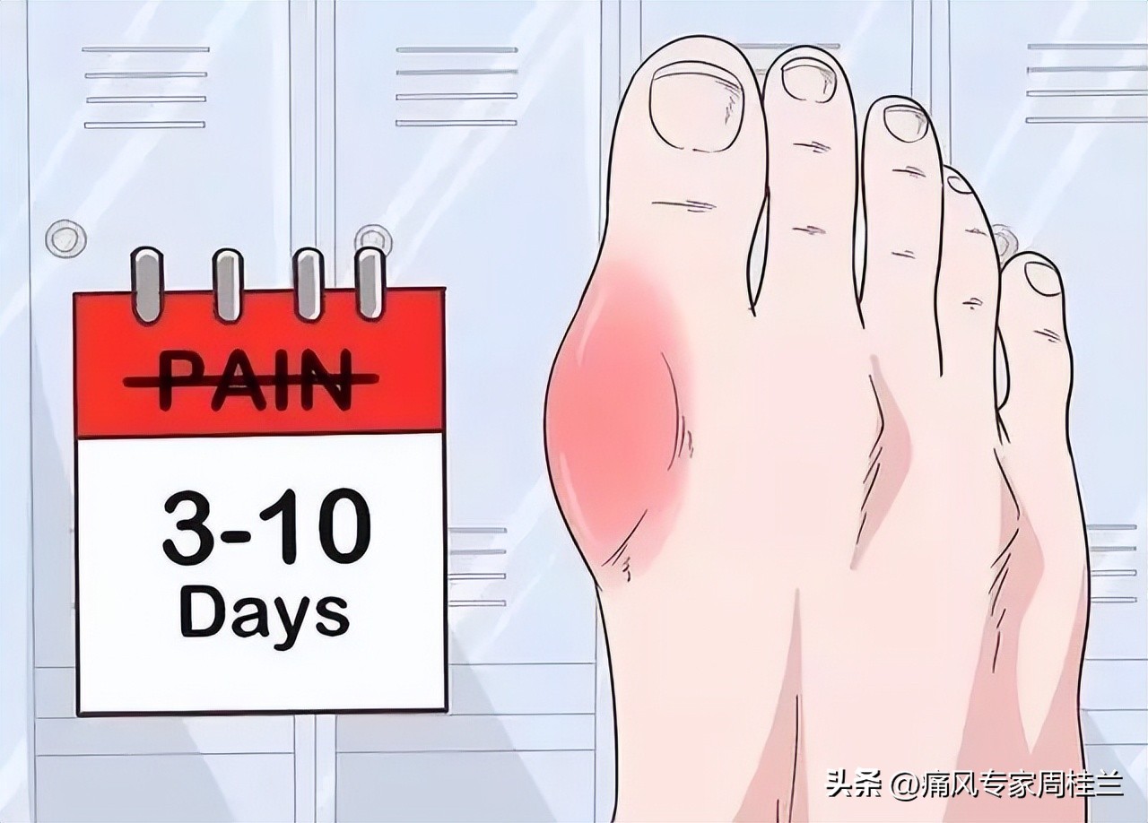 尿酸超标晚上睡觉有什么症状,育肥牛尿酸过高是什么症状