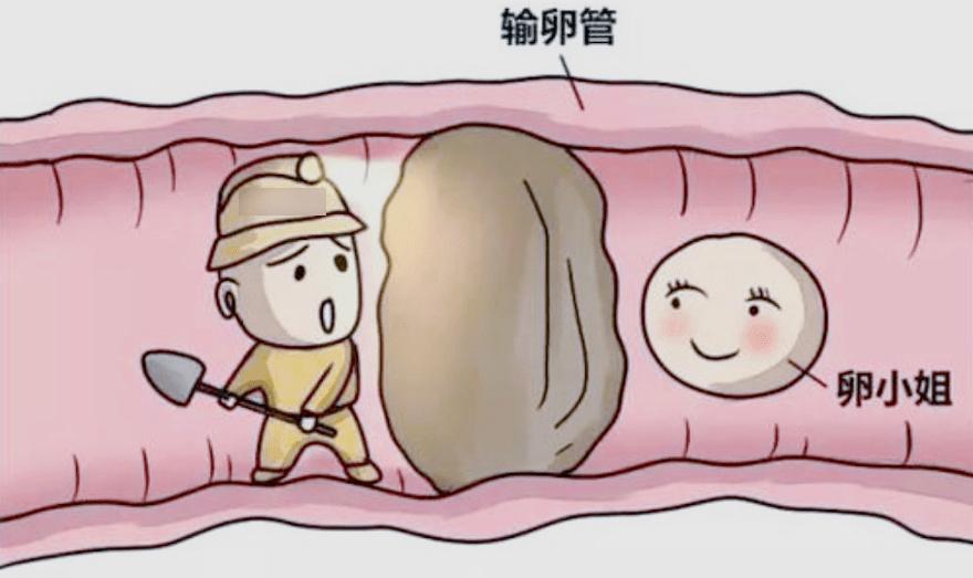 输卵管堵塞用什么办法容易怀孕,输卵管不通怎么助孕