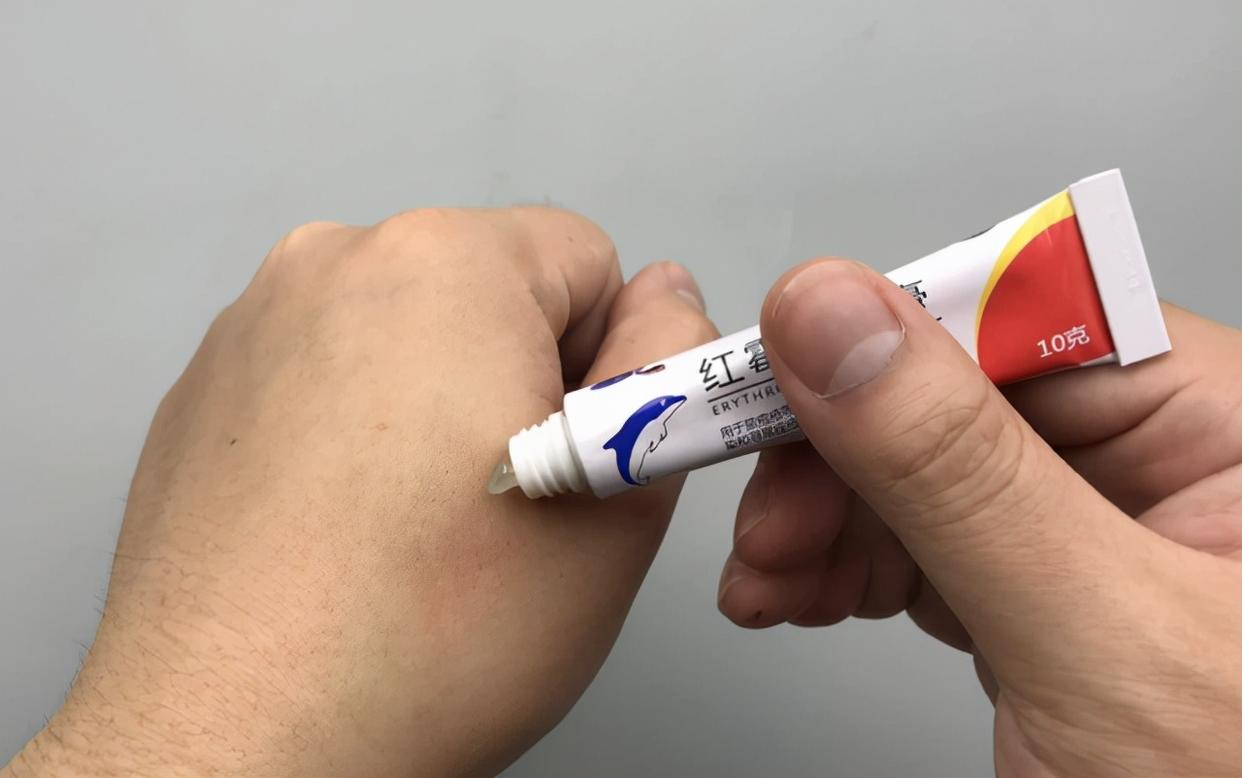 红霉素软膏抹脸上会变白吗,红霉素软膏可以擦眼下吗