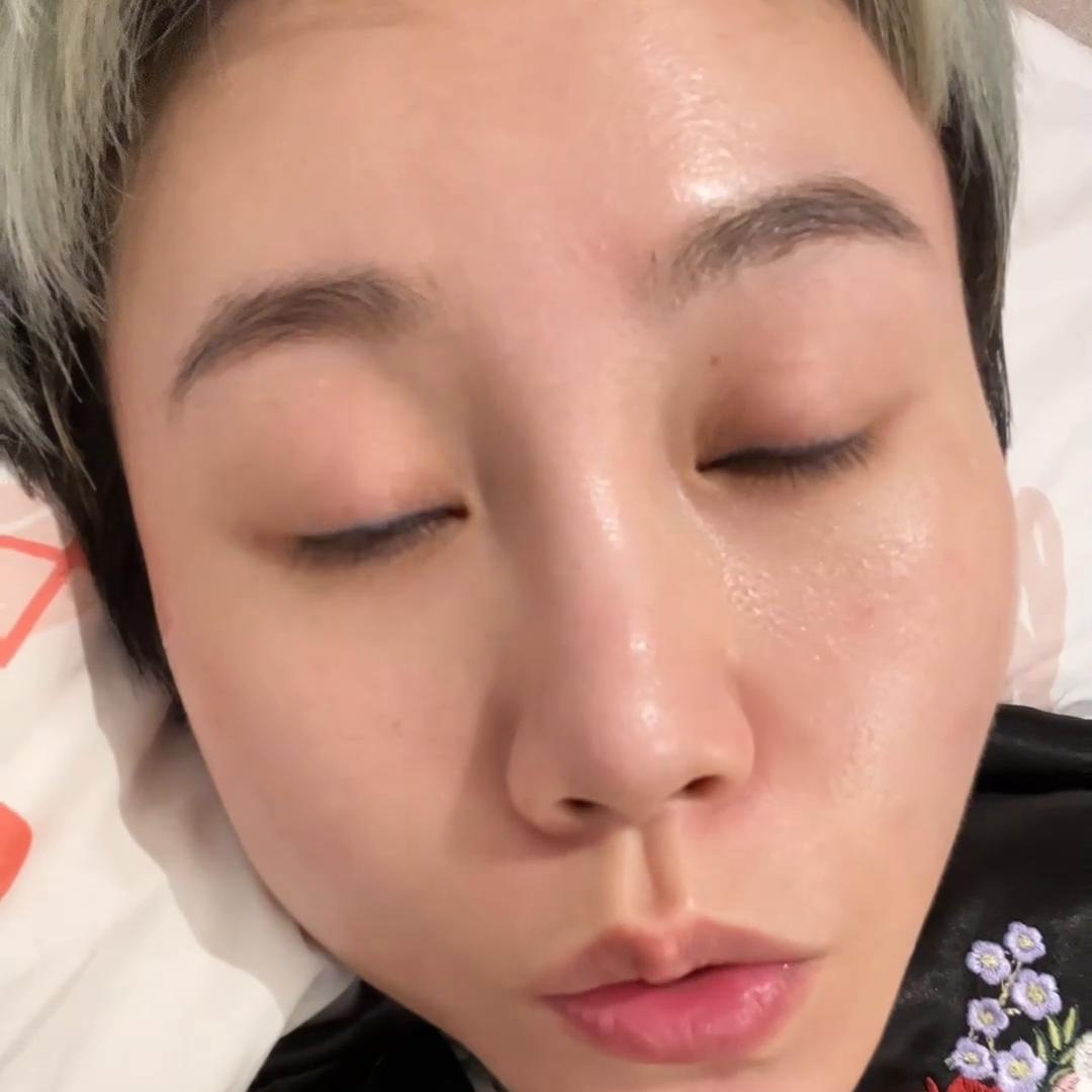 30岁容易长痘用什么洗面奶,30岁脸上突然长痘怎么回事