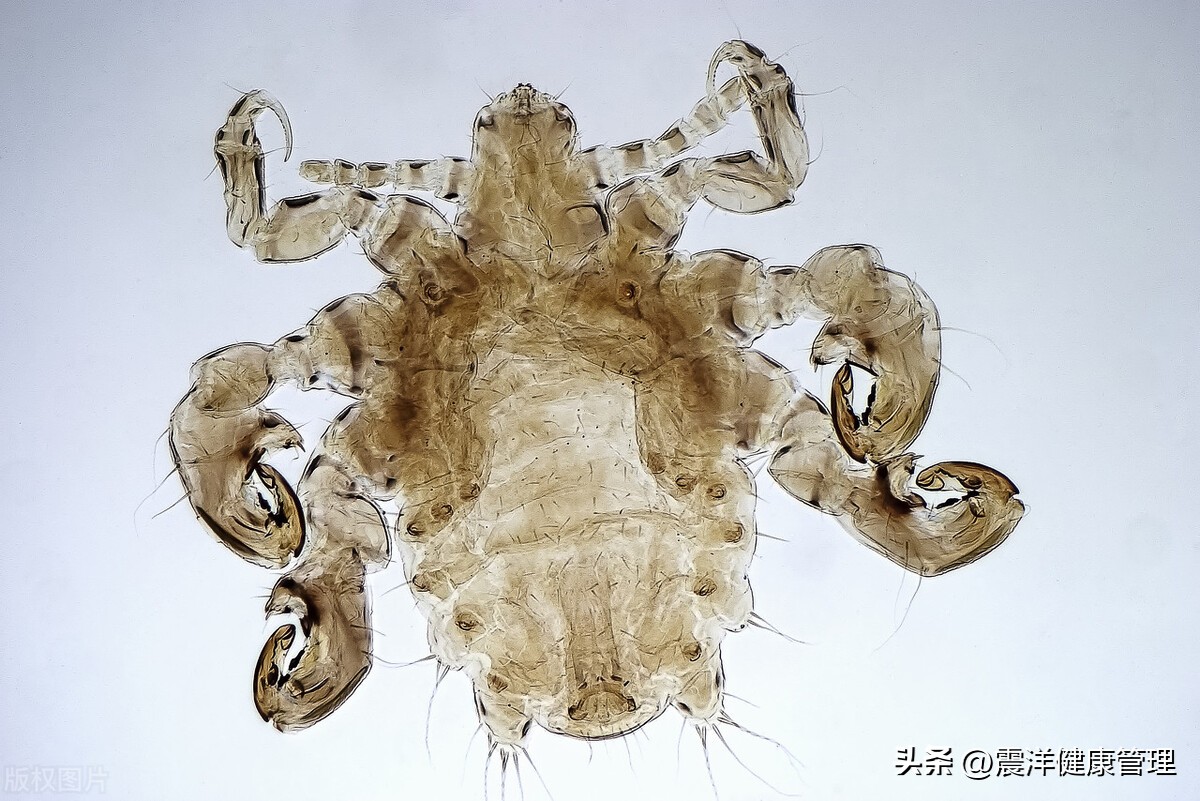 男子腹部痒，医生用镊子夹出16只阴虱！原来阴虱的传播途径有4个