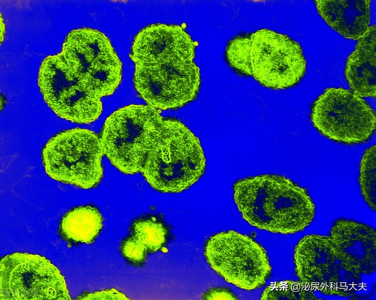 尿道口流脓是否就是淋病,尿道口流脓淋病一般怎么治