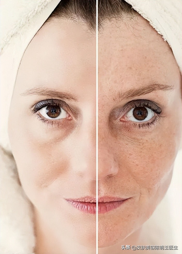 光子嫩肤全能王,光子嫩肤爱好者