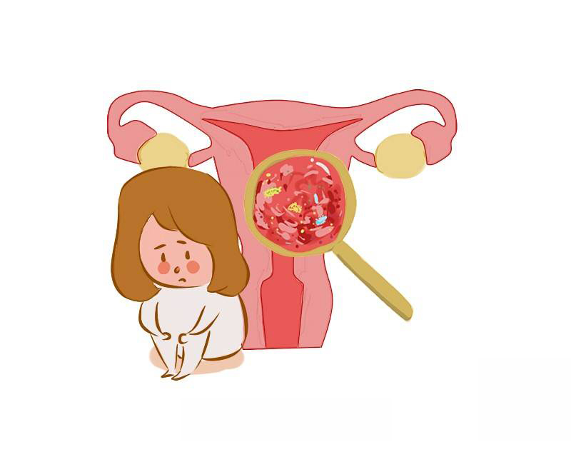 身体不明原因出血要警惕,42岁女性不规则少量出血咋回事