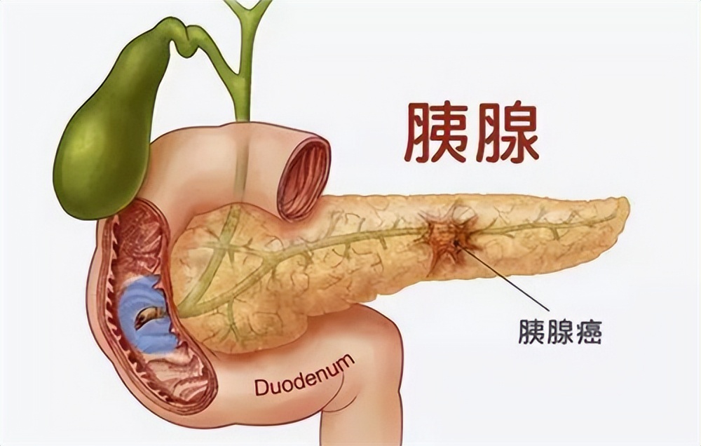 半年前肠镜检查正常但是一直腹泻,男子频繁拉肚子两次肠镜正常