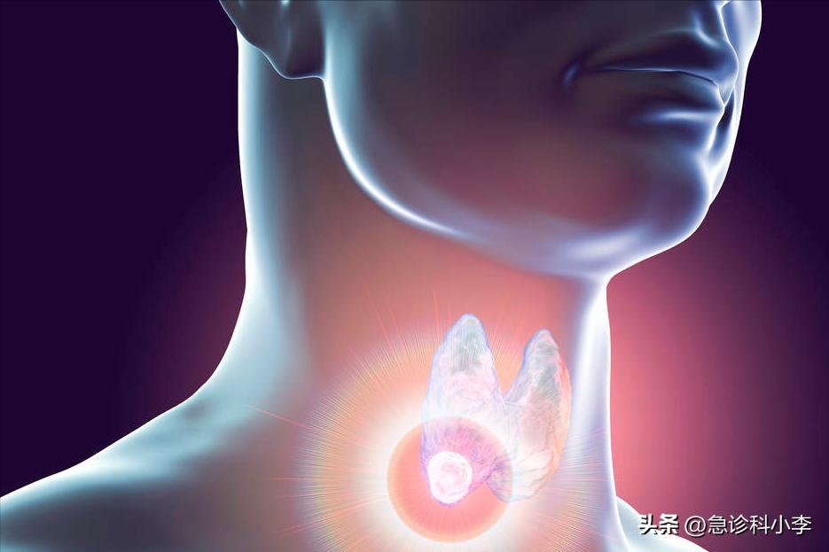 甲状腺实性结节4a癌变几率有多大,长了甲状腺结节癌变的几率有多大