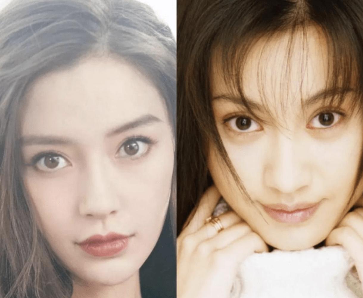 老演员整容脸变形,老年人整容前后照片