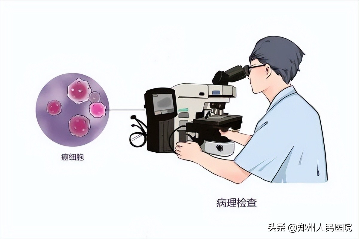 切片？捞片？烤片？听着你像在做菜，你却说在“破案”！