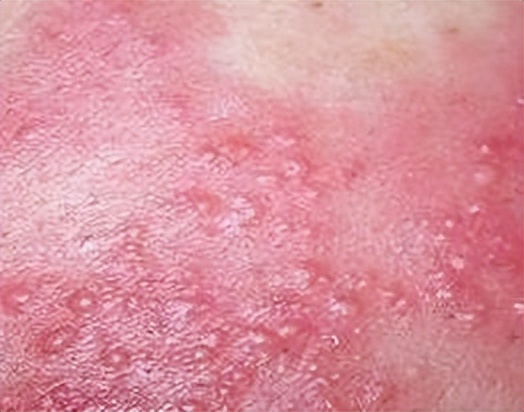 女子带3岁儿子洗药浴，不料却洗出绝症，*底卧**2年讨公道，结局如何