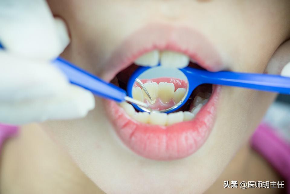 牙缝中的牙结石怎么去除,牙缝的牙结石怎么自己去除