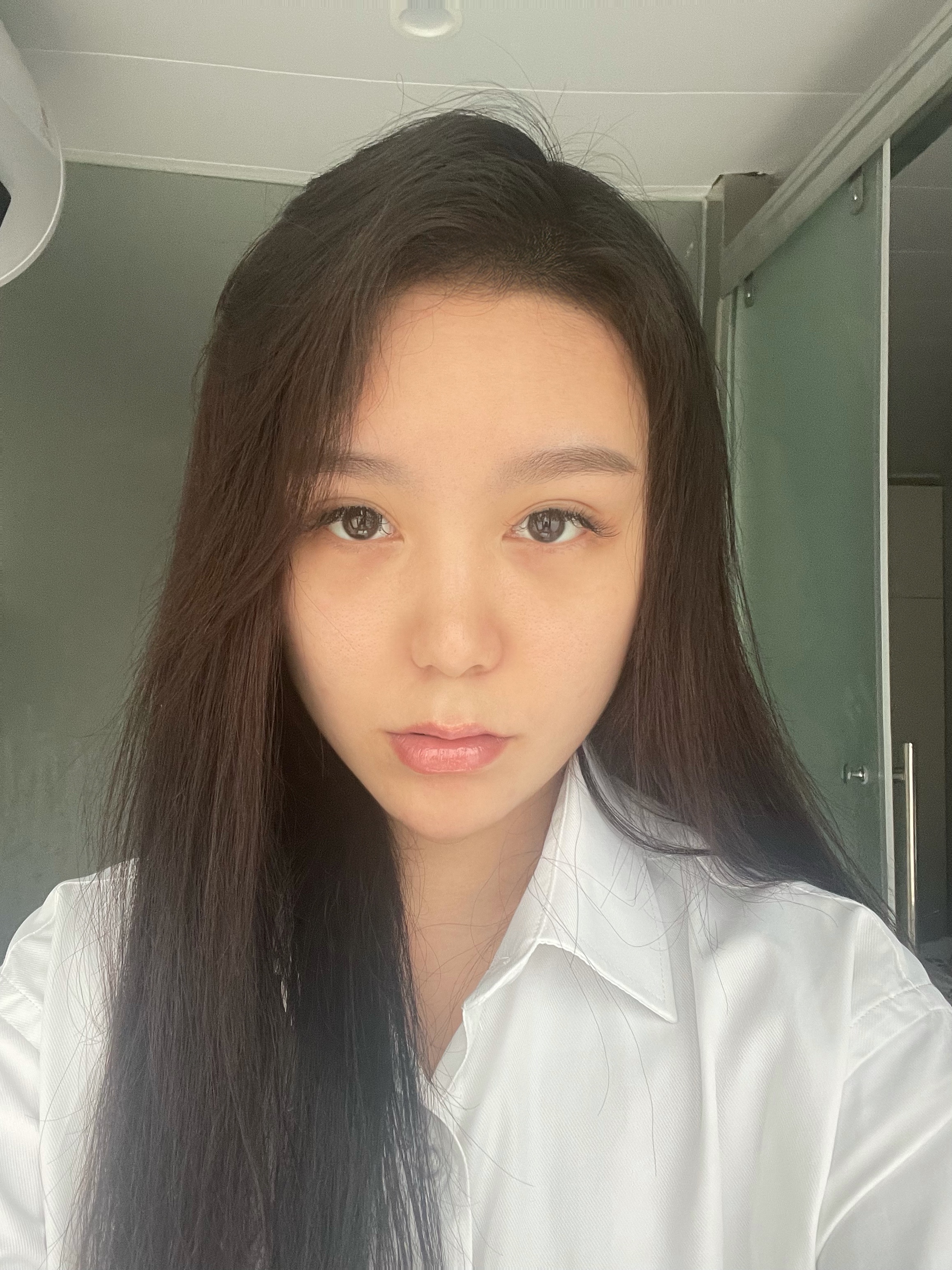 上海第九人民医院不开刀去除眼袋,顽固眼袋别担心不开刀也能变好看