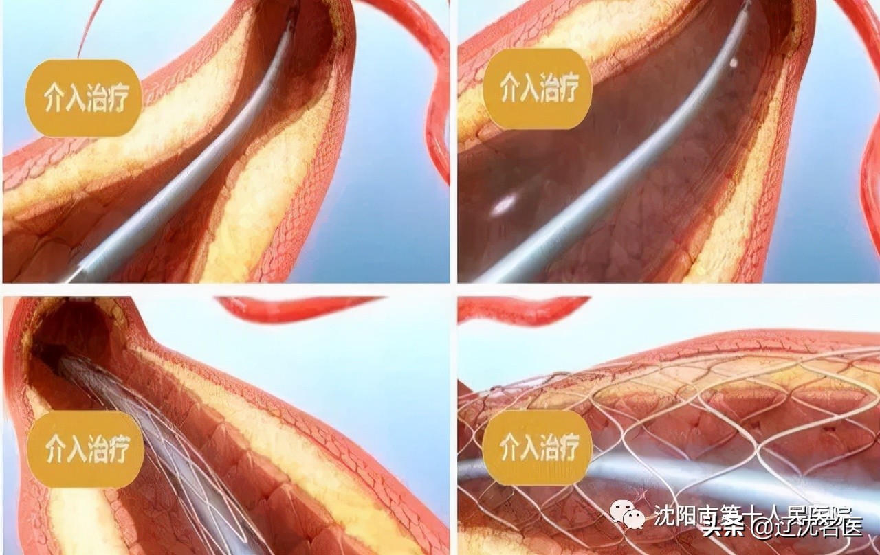 沈阳市第十一人民医院简介,沈阳第十人民医院官网