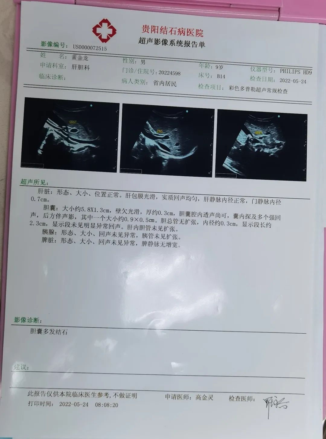 儿童胆结石的原因及解决方法,小孩胆结石有什么办法解决