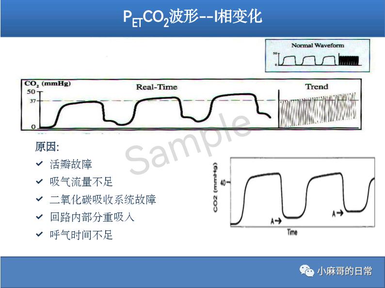 呼气末二氧化碳检测图的解读,呼气末二氧化碳检测操作视频