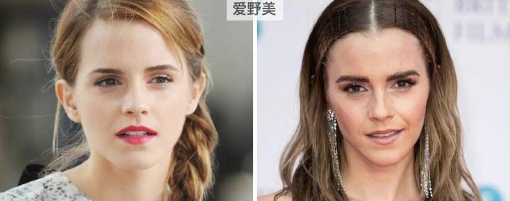 艾玛沃特森10岁到28岁颜值变化,艾玛沃特森为什么那么瘦