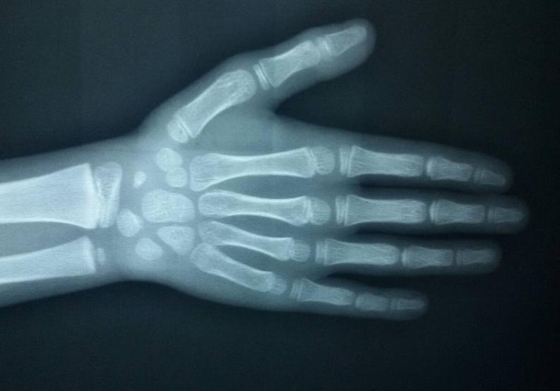 孩子长得又矮又慢？7个长高常识，家长要牢牢记住，帮孩子长更高