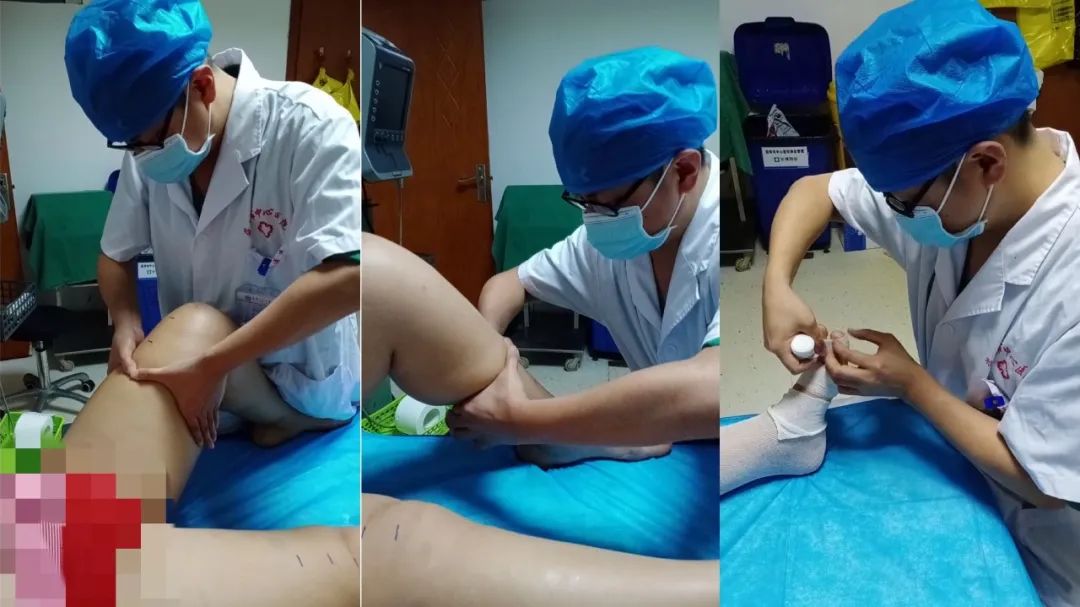 宫颈癌化疗后腿肿怎么样消肿,做了宫颈癌手术腿肿是什么原因