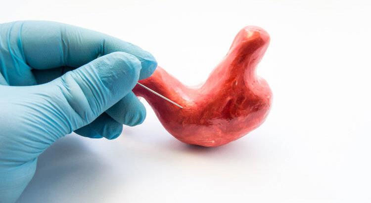 鱼刺卡喉咙你别再用这些土方法,鱼刺卡喉别吞米饭