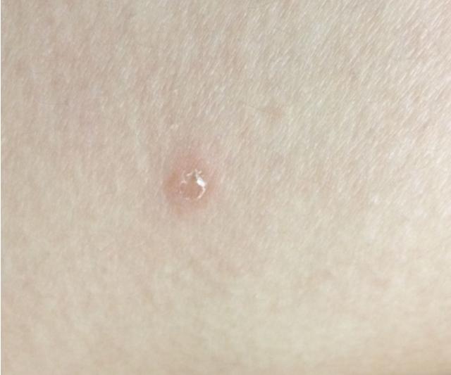 怎么在*生活性**前，判断对象有没有性病？