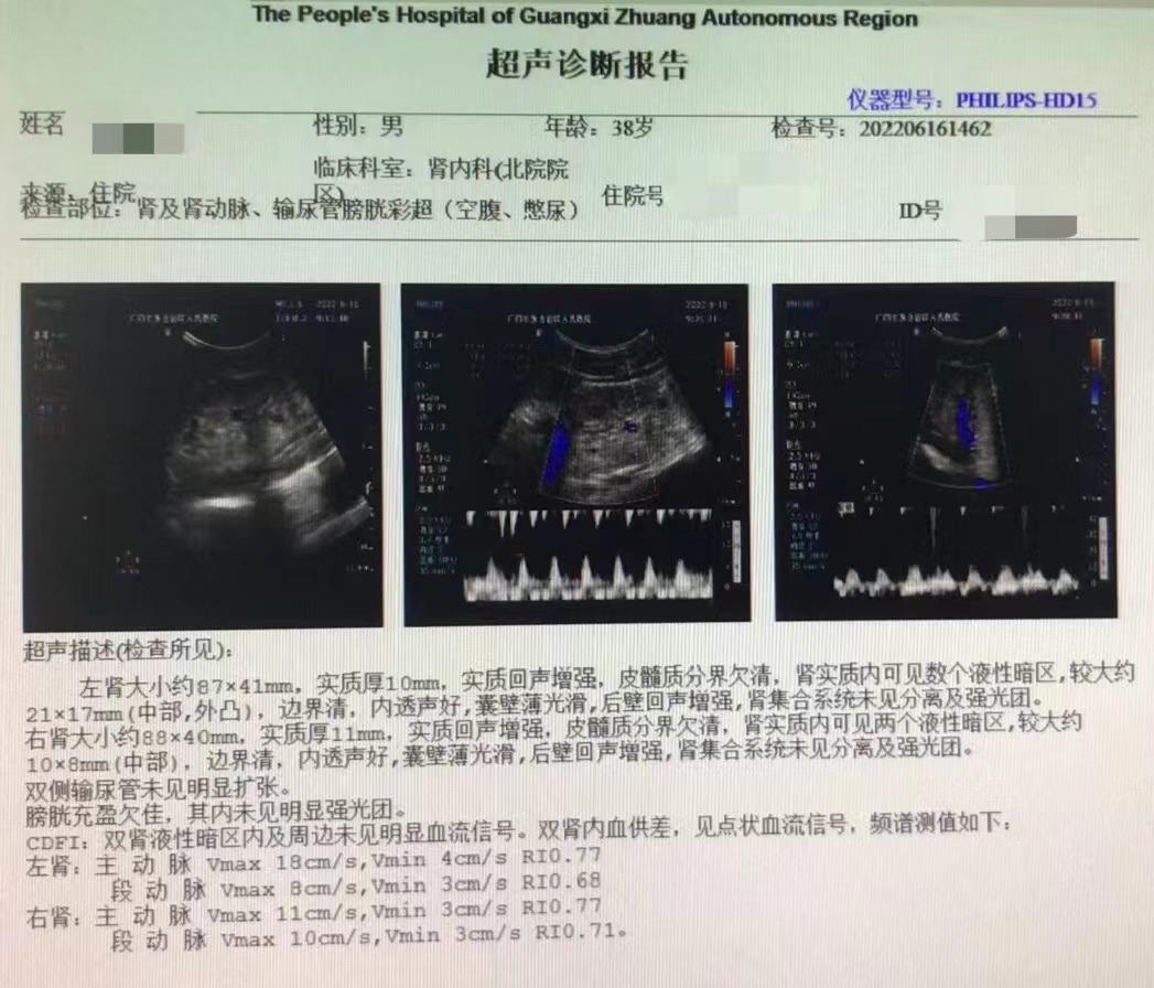 泌尿系统彩超检查要脱裤子吗,泌尿系统彩超检查需要憋尿吗