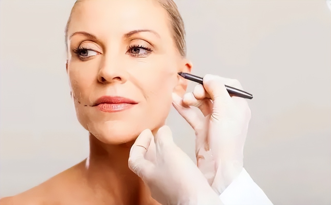 全脸皱纹拉皮手术对比,面部大拉皮恢复的真实感受