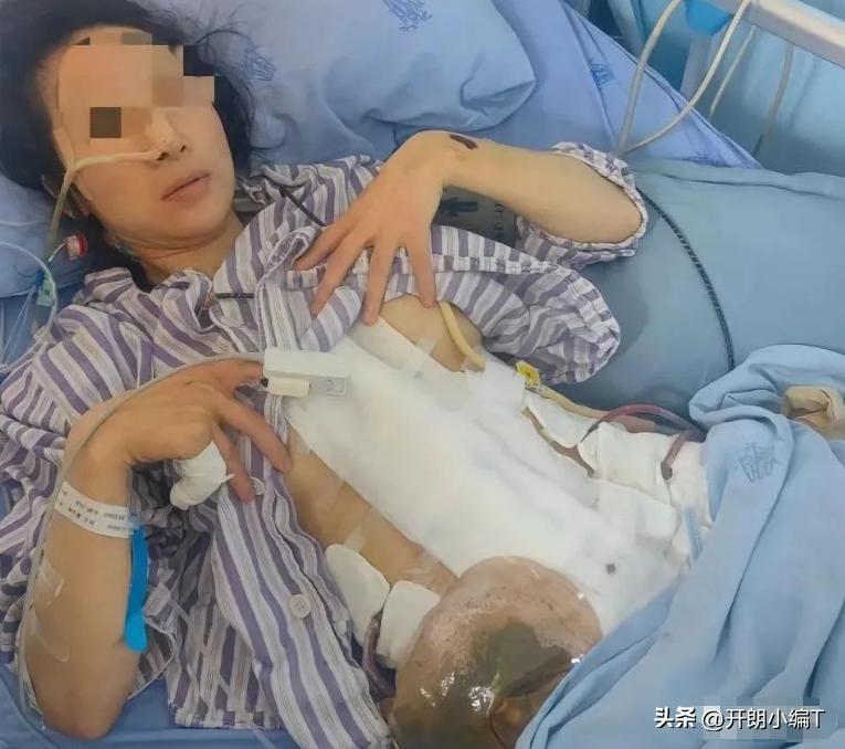 孕妇泼汤汁烫伤后续结果,女子怀孕6个月被烧焦