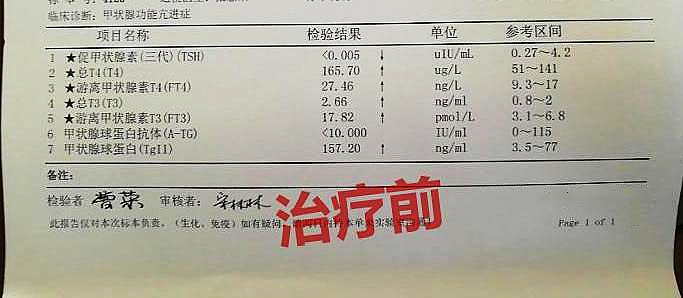 甲亢甲状腺肿大推荐什么中药,甲亢复发吃中药有效吗