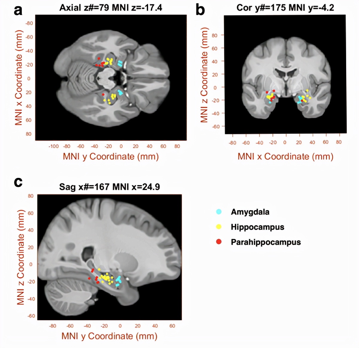 突然忘记自己要做什么了怎么办,突然忘记要做什么事情是什么症状