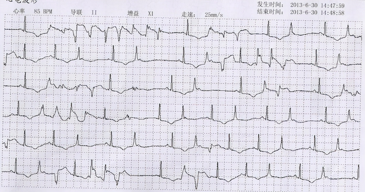男子饮酒后晕倒医生无力回天,男子喝酒腹痛急诊