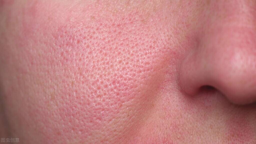 有效修复毛囊缩小毛孔,怎样去除黑头缩小毛孔