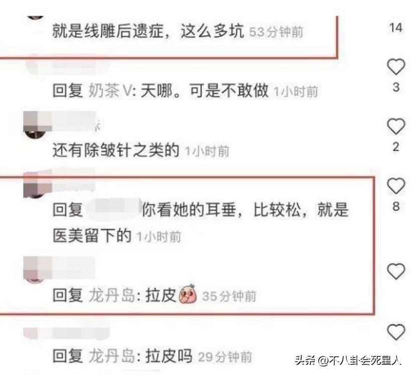 拉皮的女明星后遗症,拉皮失败的明星