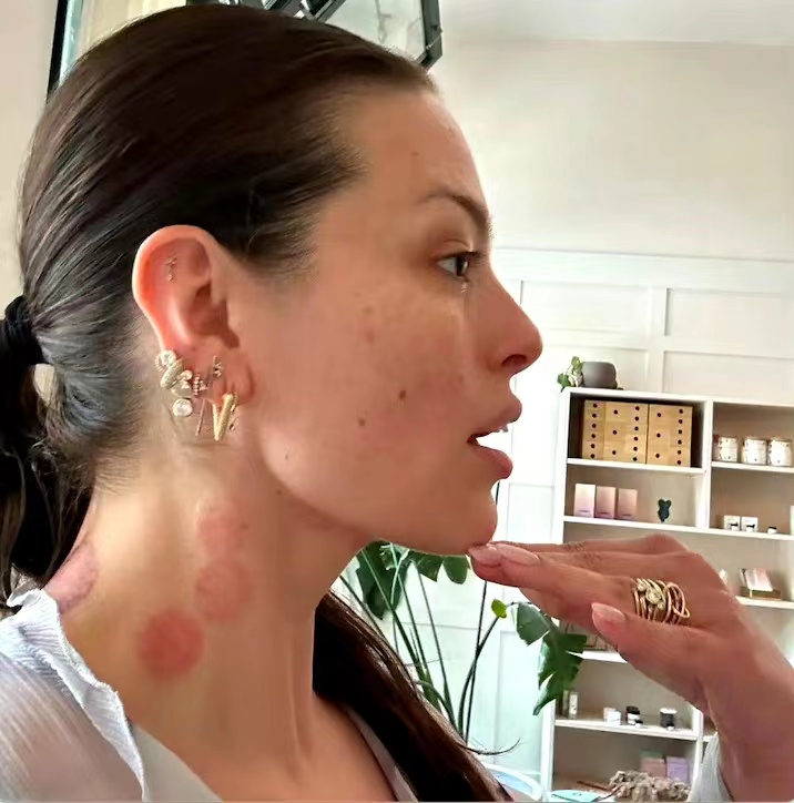 180斤大码超模靠针灸拔火罐美容!穿吊带身材火辣,自信到骨子里