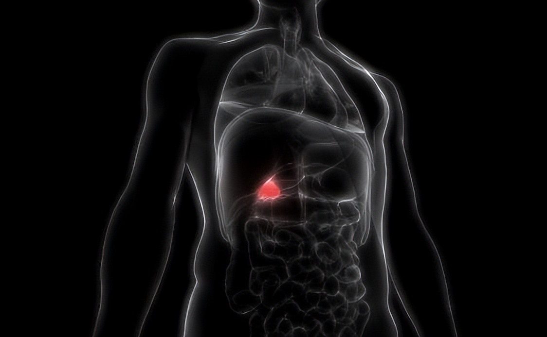 胆囊息肉切除后遗症怎样才能恢复,胆管结石胆囊结石切除有后遗症吗