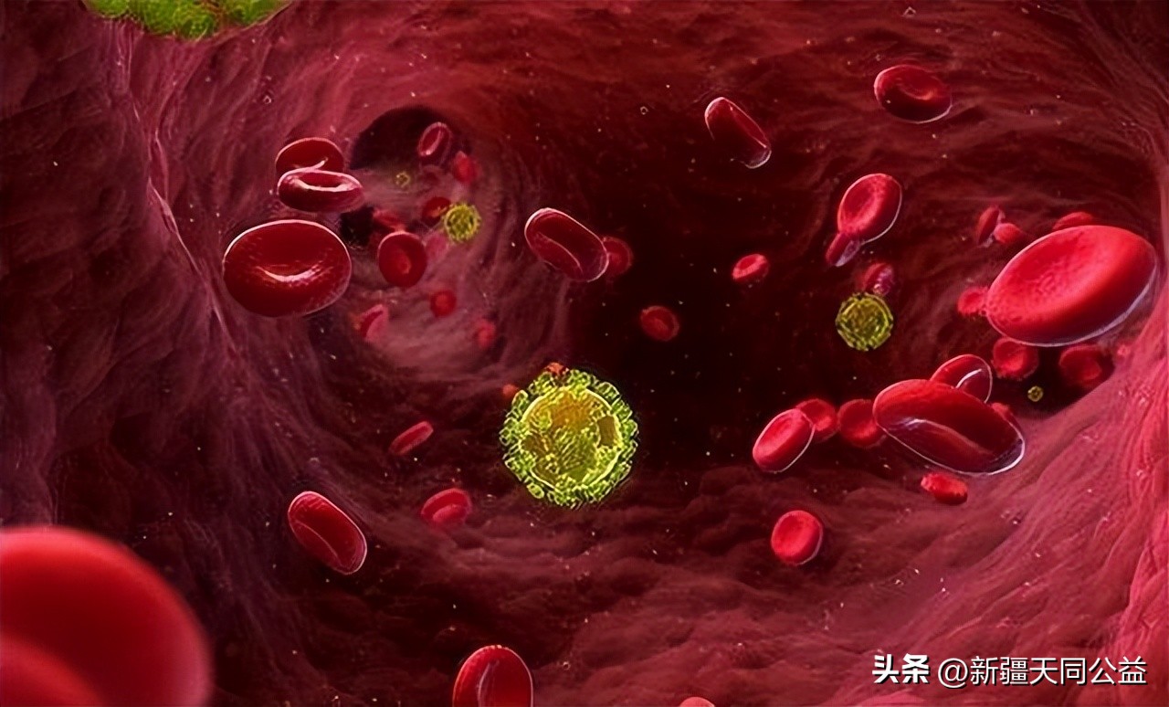 持续低烧查出艾滋病,男子发热20天被确诊艾滋病