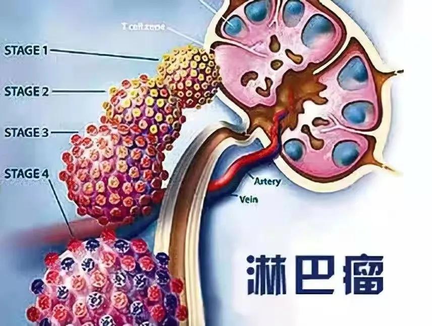 120万抗癌药真的能彻底终结癌症吗,120万一针抗癌药危险期几天