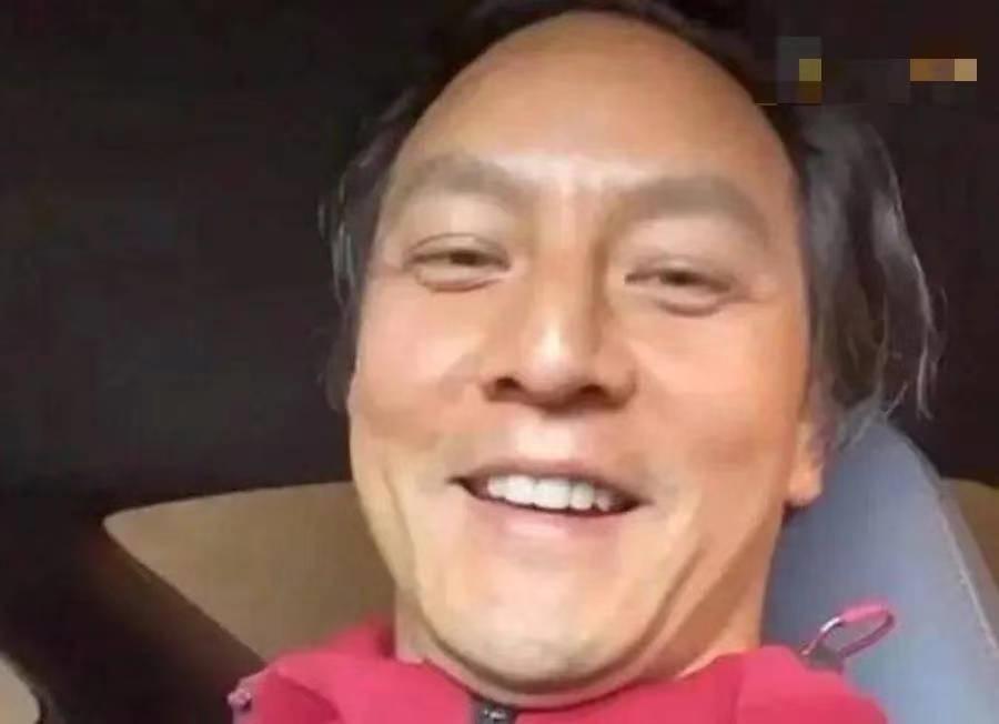 有哪些明星头发秃顶,秃顶明星发际线