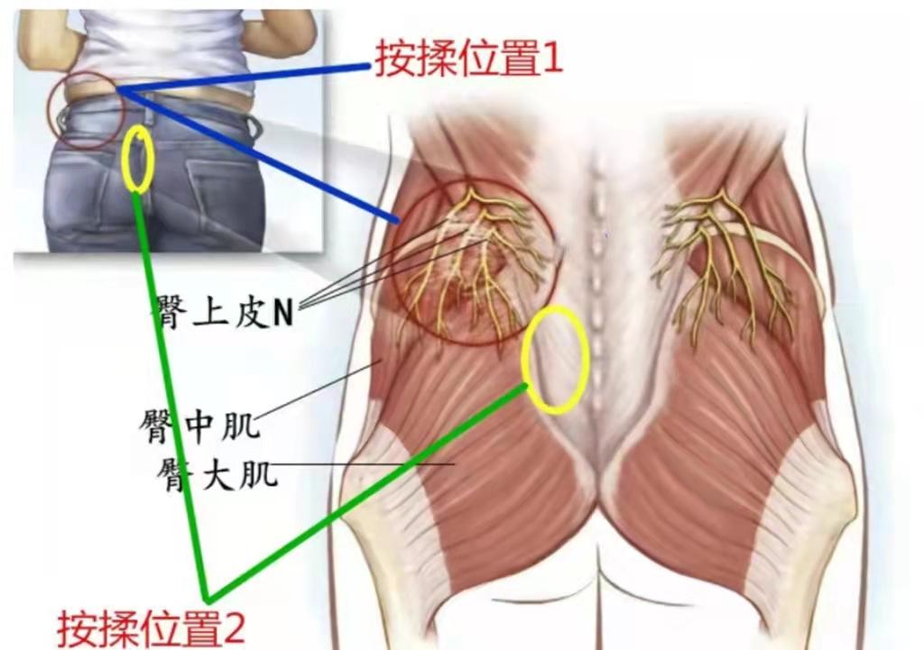 真正好的腰椎间盘突出治疗方法,腰椎间盘突出不做有效治疗的后果