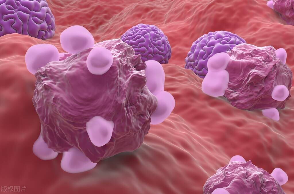 为什么女性“下面”会发臭、有异味？医生：多半是3个原因导致