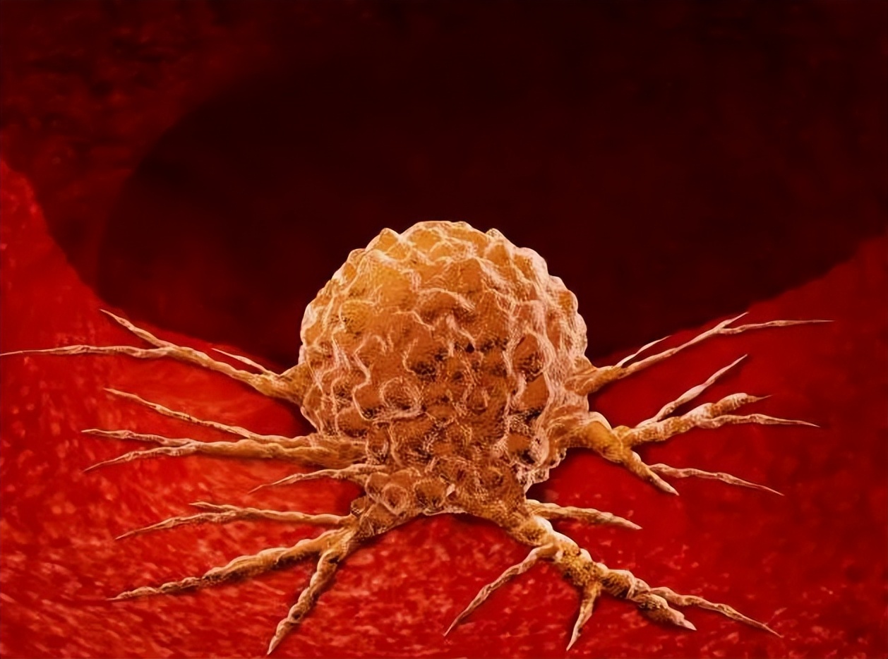 发现囊肿需要注意什么,医生说有囊肿但不要紧