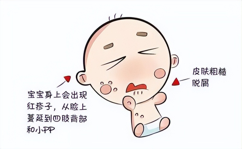 宝宝湿疹老是反反复复怎么办,宝宝湿疹反复发作该怎么办