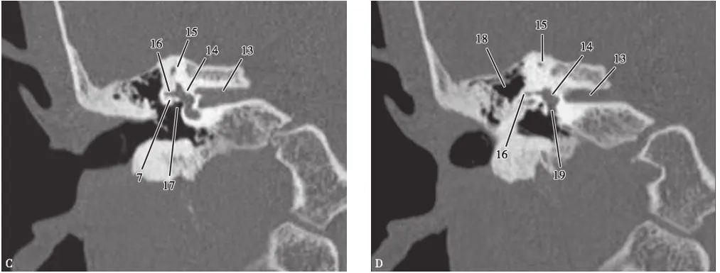 耳部解剖结构和生理功能,耳部解剖笔记
