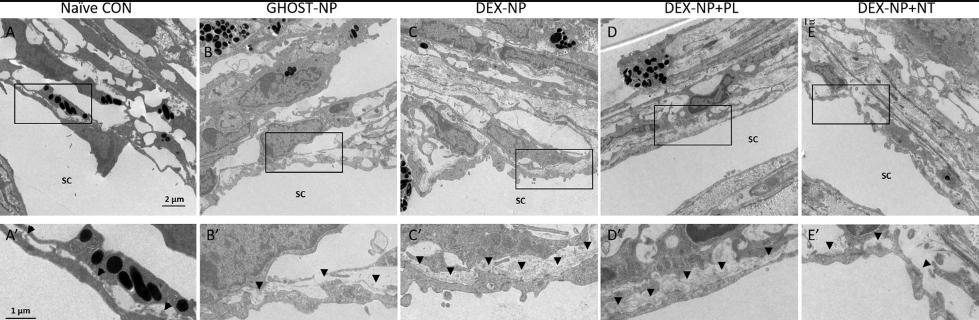 rho激酶抑制剂多少钱,rho激酶抑制剂是什么
