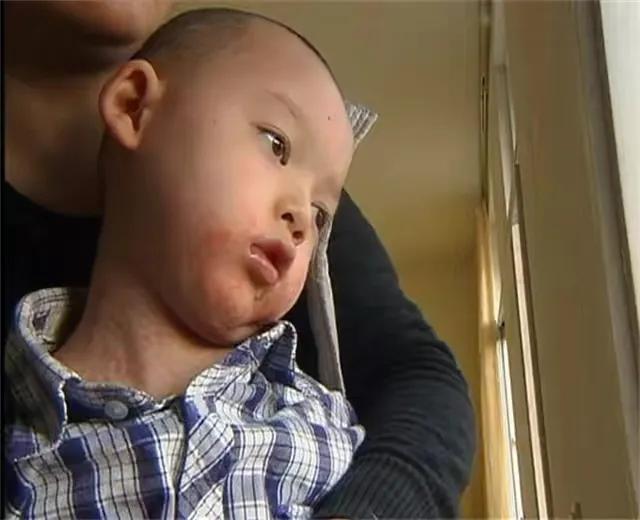 孩子药浴洗出绝症母亲肠子悔青,给孩子洗药浴洗出绝症