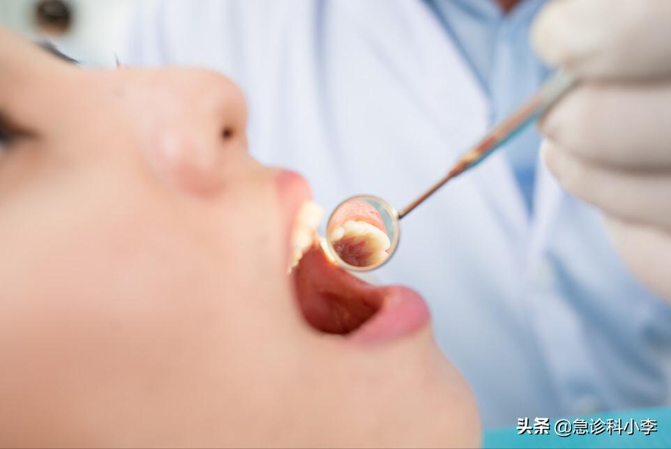 牙缝里的牙结石如何清除干净,在牙缝里的牙结石要怎么去除