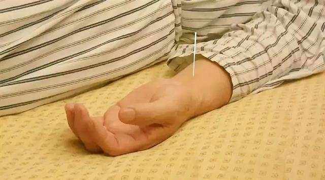 基于“阴病治阳”理论，探析针刺法治疗冠心病的作用