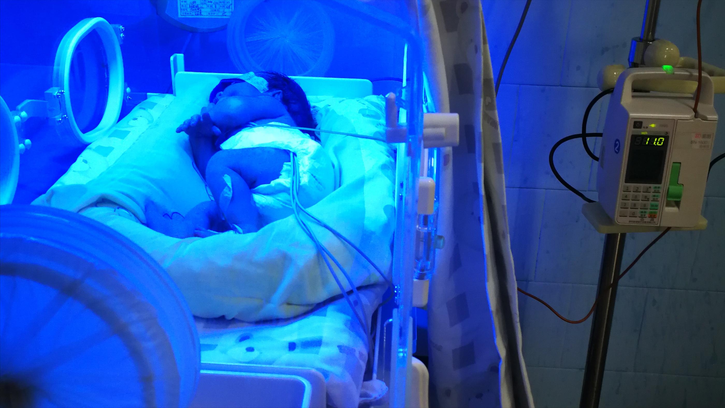 宝宝出生三天了面色发黄,新生儿出生三天皮肤发黄