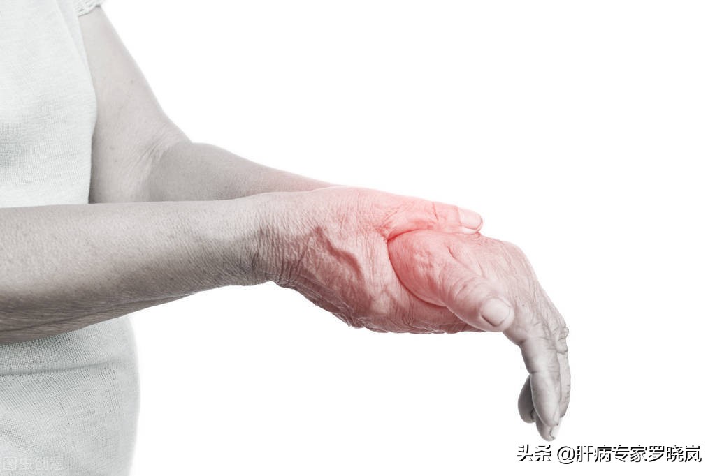 肝炎中医怎么预防和治疗,肝炎有哪些中药治疗