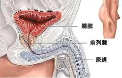 前列腺增生用啥药,前列腺增生的治疗方法有哪些呀